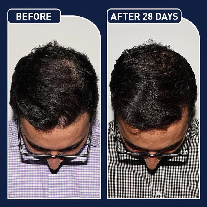 FEG Plus Hair Strong Growth Spray