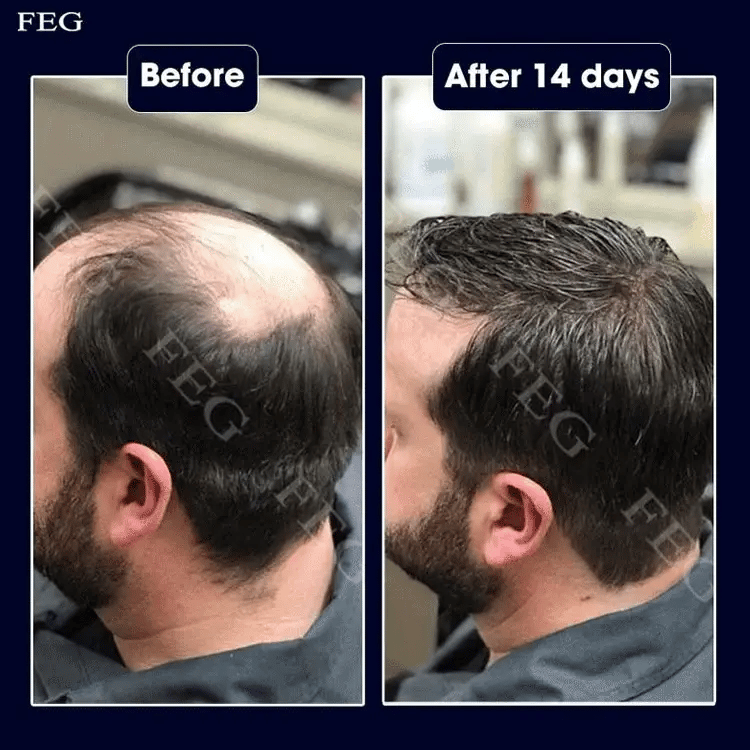 FEG Plus Hair Strong Growth Spray